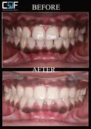 Coimbatore Dental Foundation