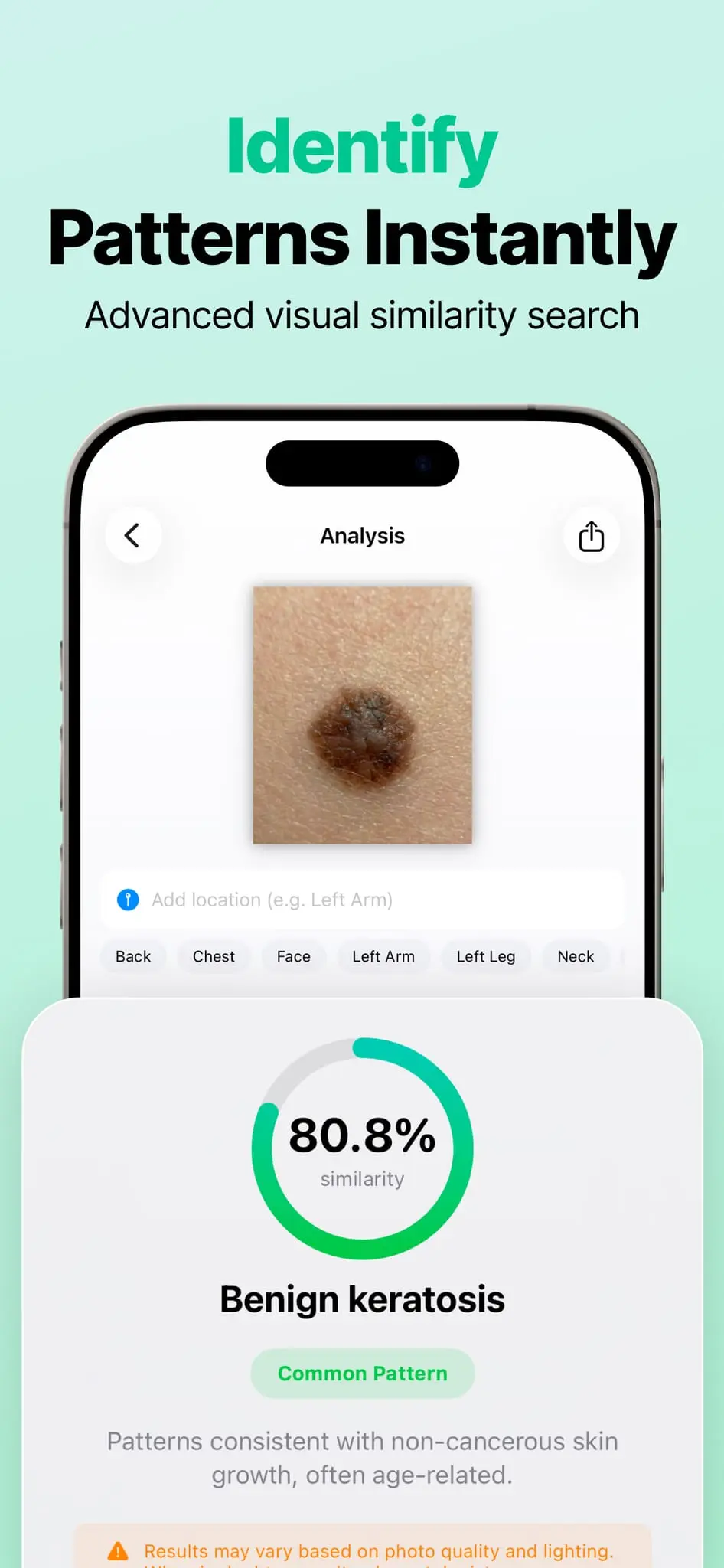 Screenshot 2 of AI Mole Analyzer