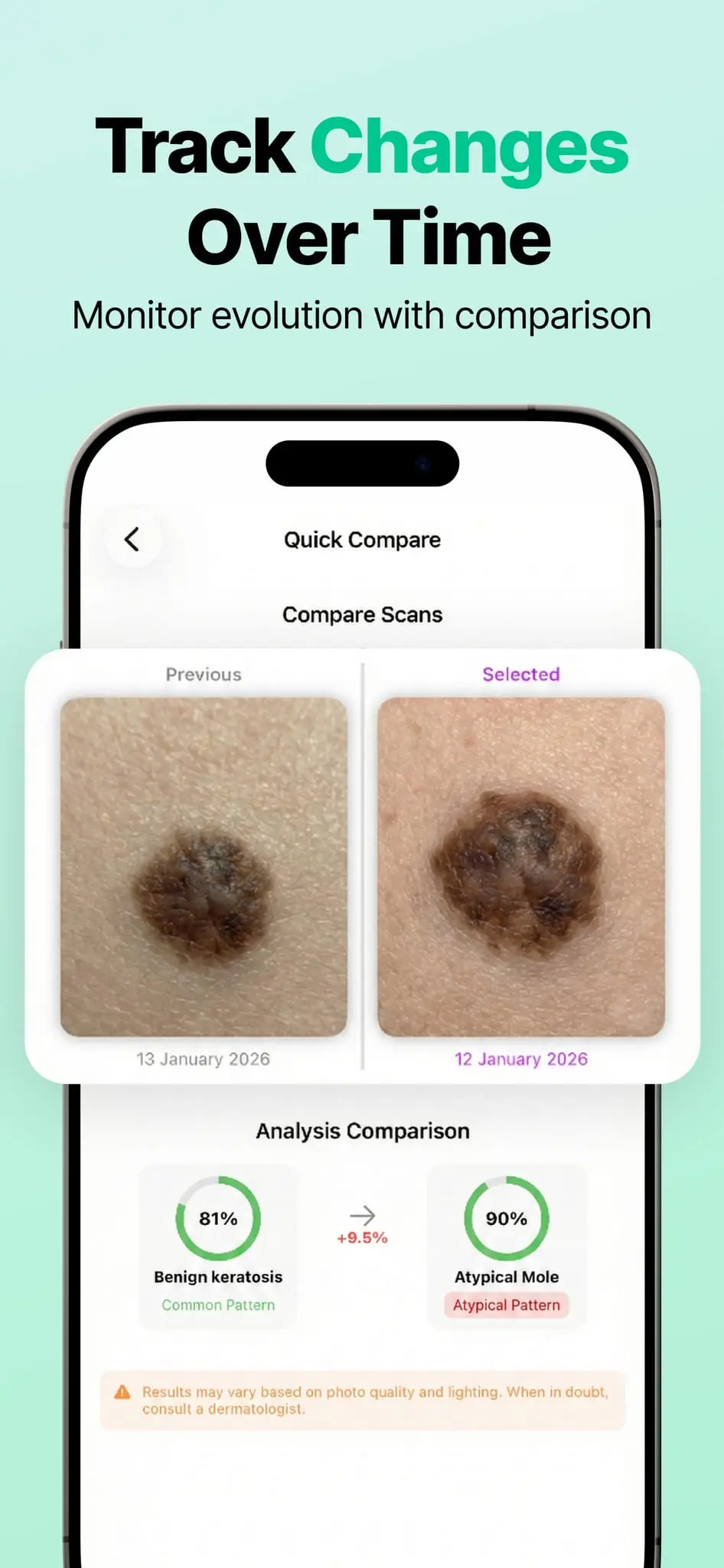 Screenshot 4 of AI Mole Analyzer