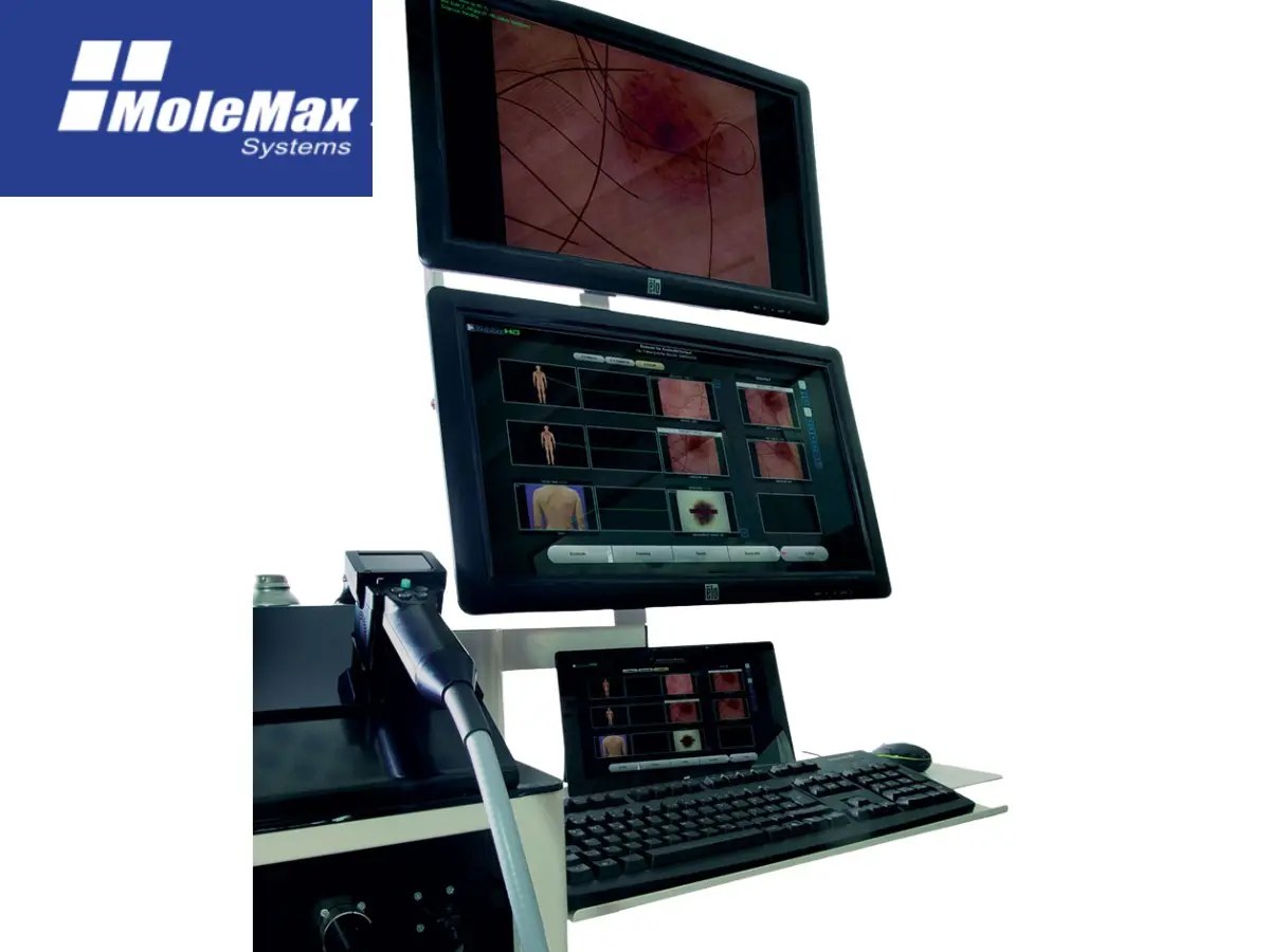 Screenshot 6 of MoleMax Systems