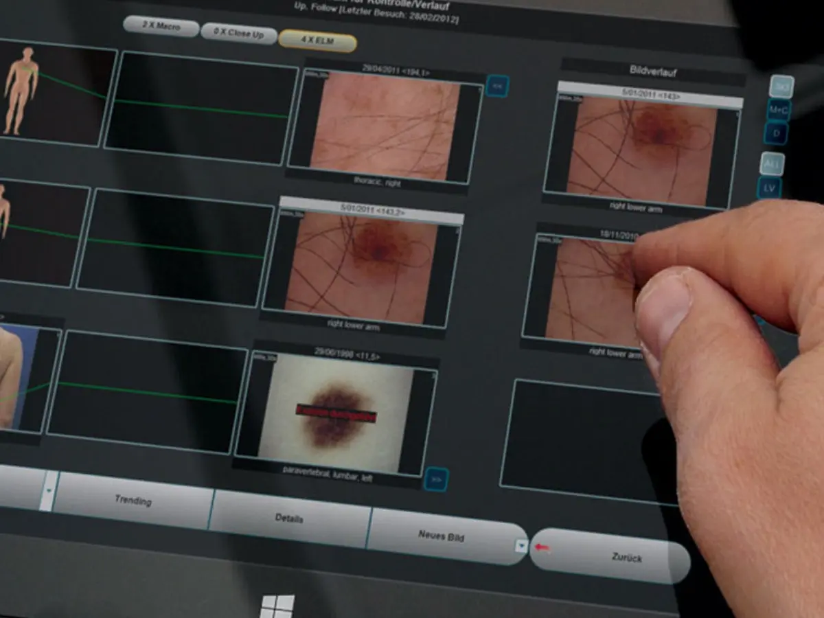 Screenshot 9 of MoleMax Systems