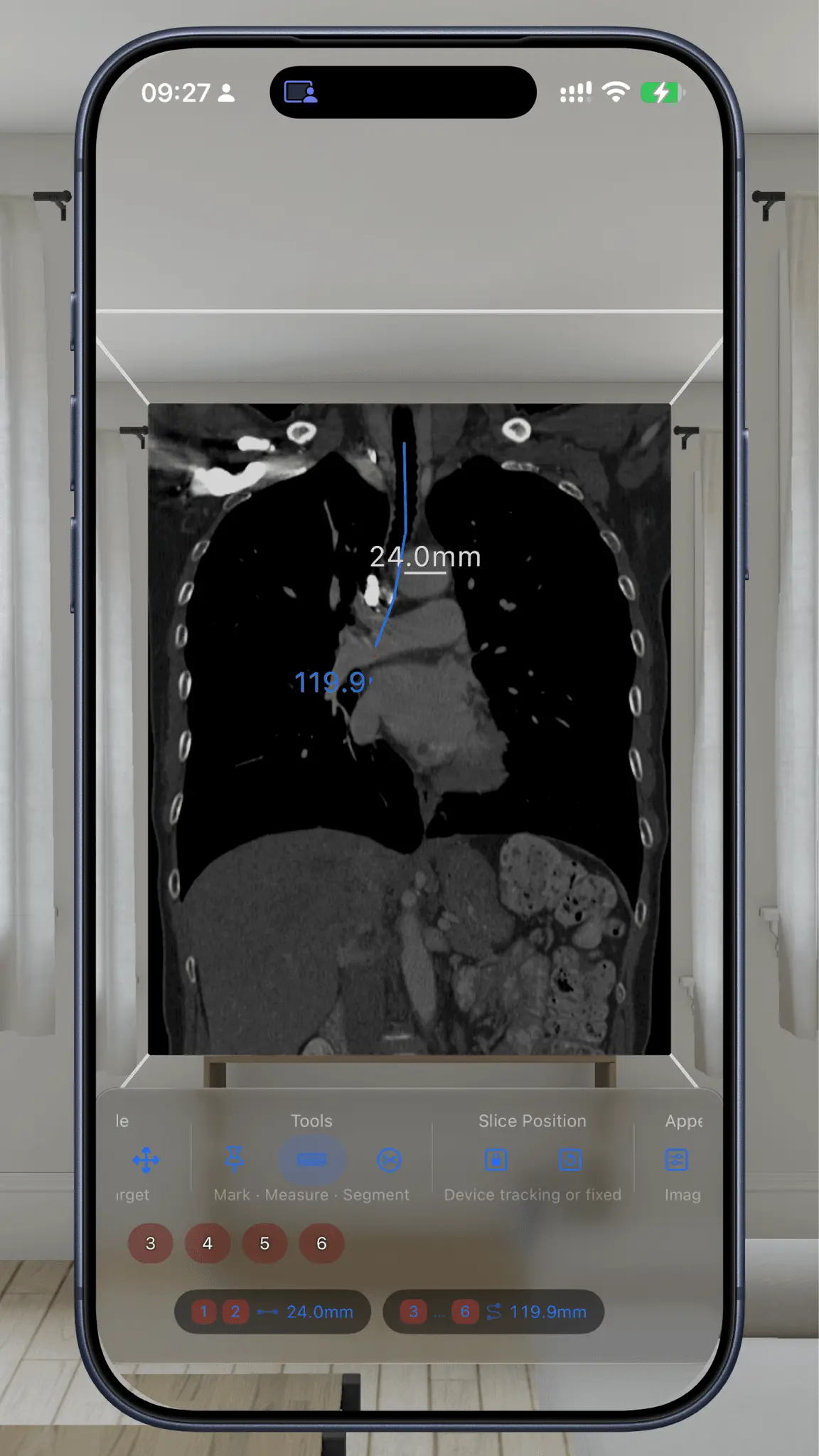 Screenshot 1 of VoxelVision AR Medical Imaging