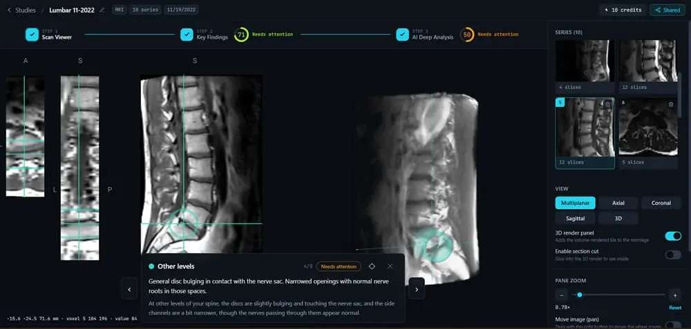 Screenshot 1 of Read Your Scan