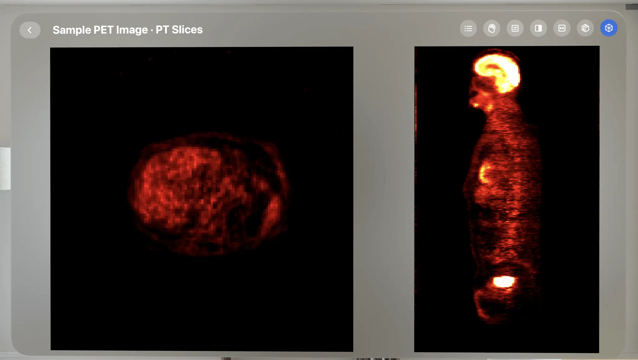 Screenshot 4 of VoxelVision AR Medical Imaging