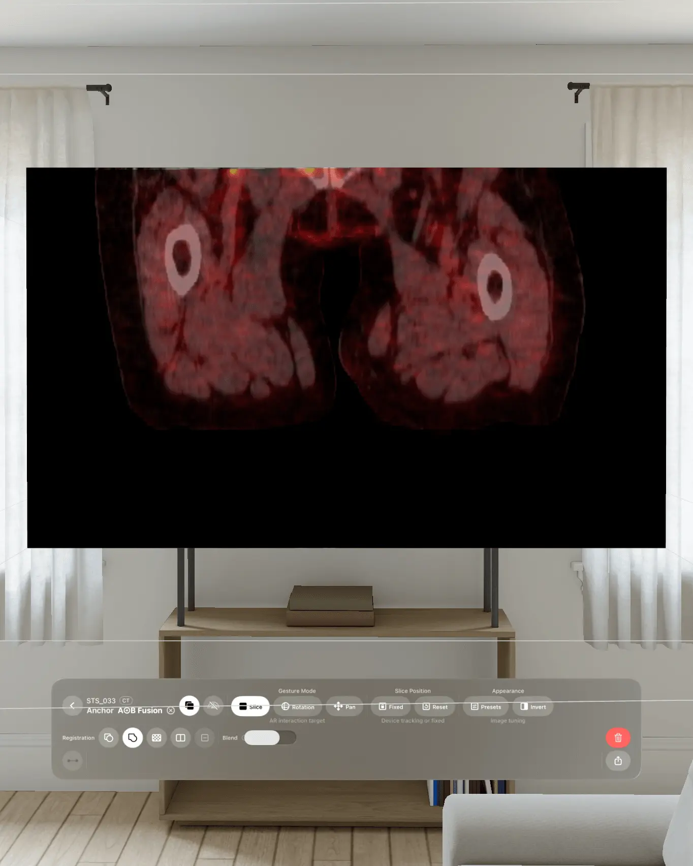 Screenshot 3 of VoxelVision AR Medical Imaging