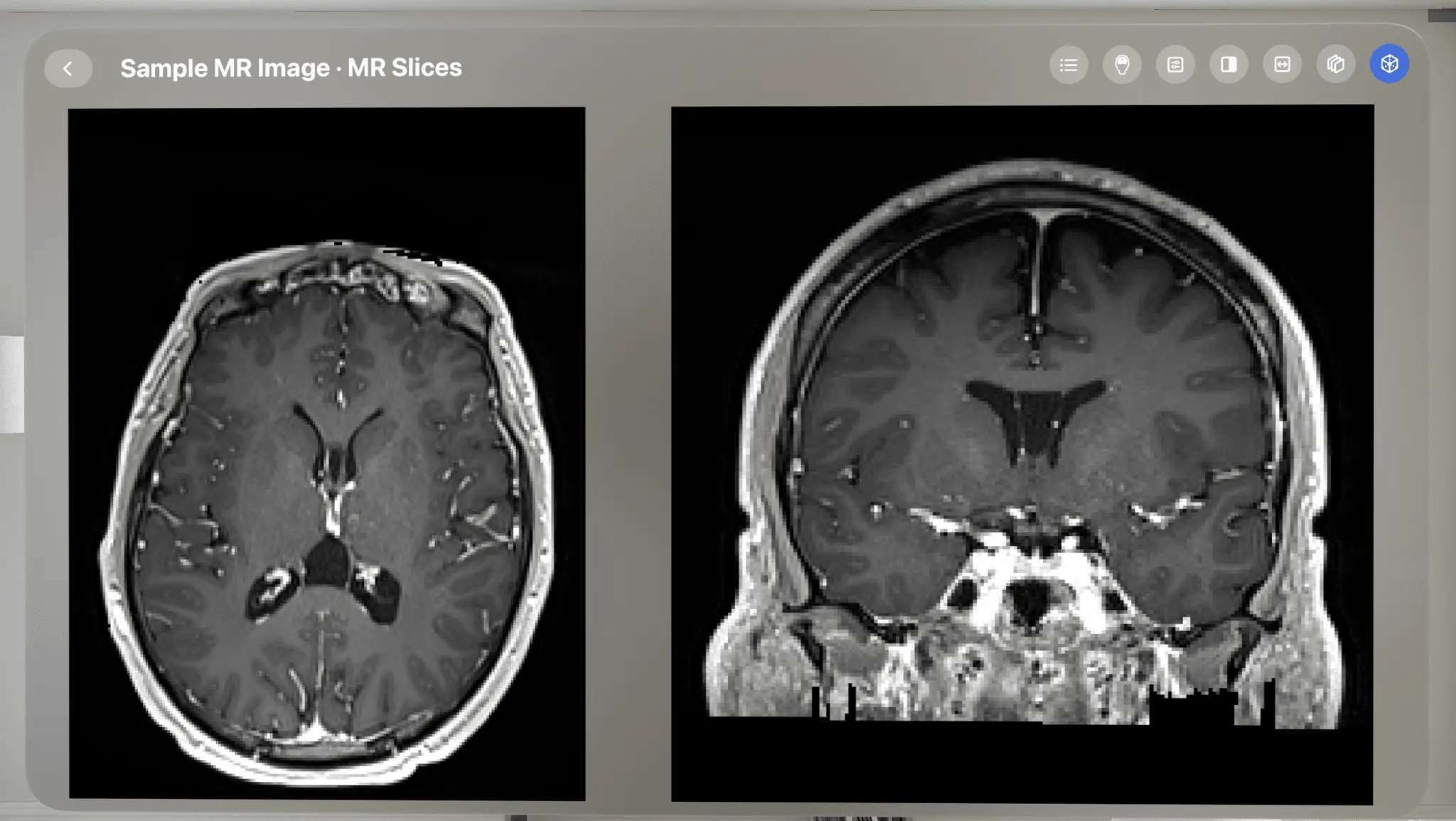 Screenshot 5 of VoxelVision AR Medical Imaging