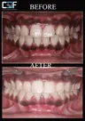Coimbatore Dental Foundation